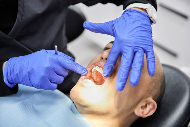 Best Emergency Wisdom Teeth Removal in New Hempstead, NY